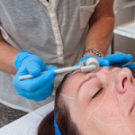 Cosmetic Courses: photo showing Dermaroller training 