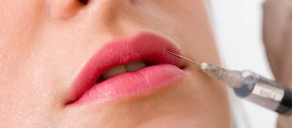 Cosmetic Courses; banner showing the side effects of lip filler