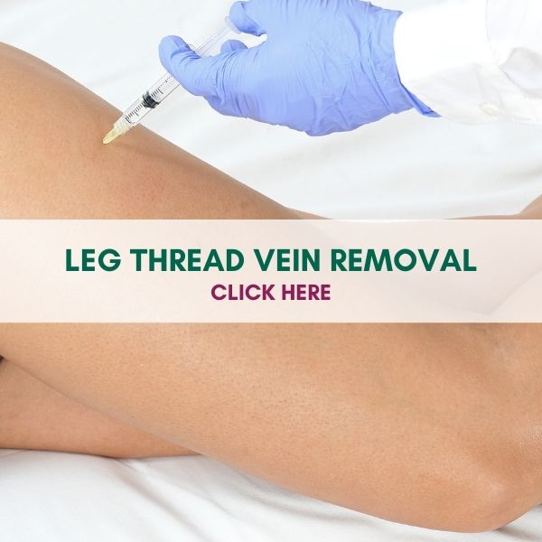 LEG THREAD VEIN REMOVAL MODELS COSMETIC COURSES