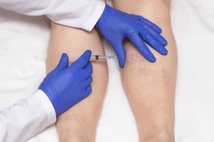 Microsclerotherapy Training Course with Cosmetic Courses (1)