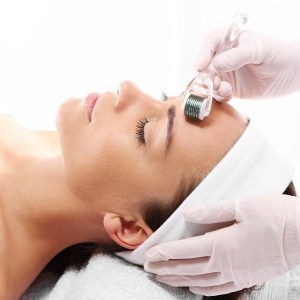 micro-needling