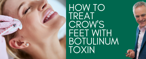 How to Treat Crow's Feet with Botulinum Toxin (1)