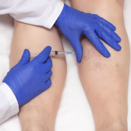 Microsclerotherapy Training Course