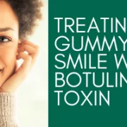 Treating a Gummy Smile with Botulinum Toxin