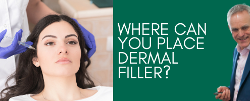 Where Can You Place Dermal Filler