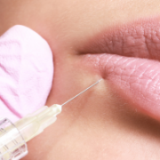 Lip Filler Injection Techniques