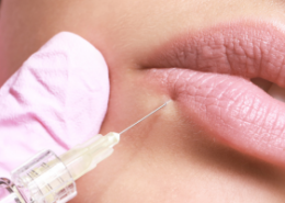 Lip Filler Injection Techniques