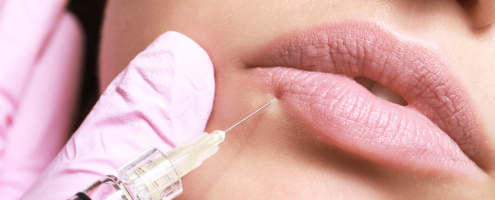 Lip Filler Injection Techniques