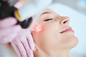 co2 laser image 2 CO2 Fractional Laser Masterclass