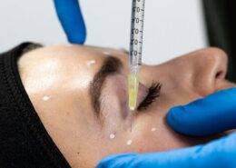 Getting Started in Aesthetics - Intermediate Botox and Dermal Filler